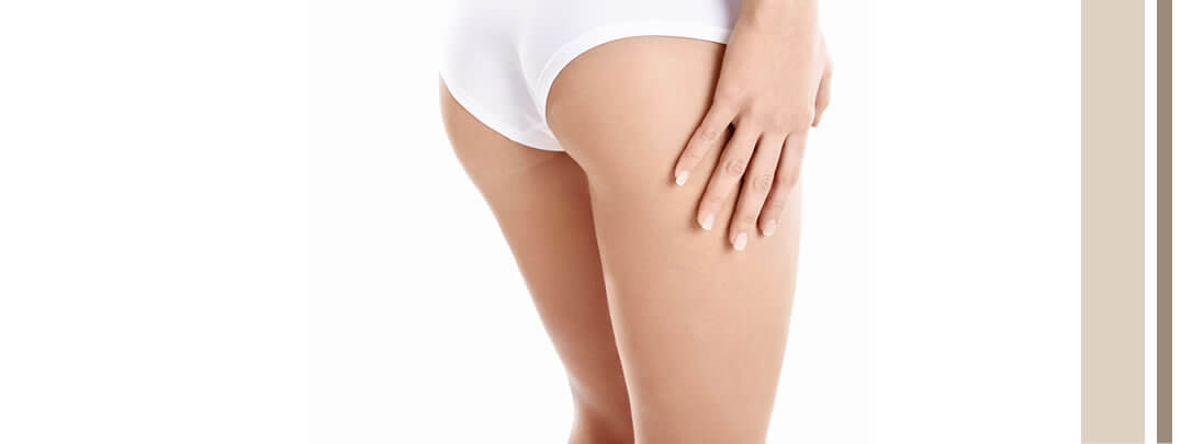 Easy Cellulite Treatments to Get Cellulite Free Skin