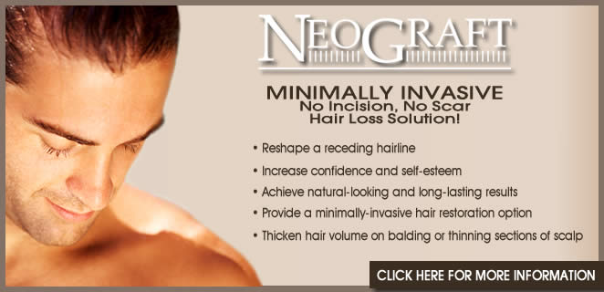 NeoGraft Hair Restoration