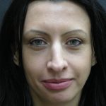 Rhinoplasty Before & After Patient #2877