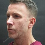 Rhinoplasty Before & After Patient #2870