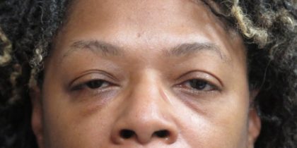 Eyelid Surgery Before & After Patient #11899