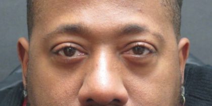 Eyelid Surgery Before & After Patient #11890
